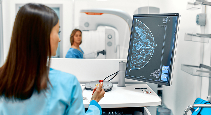 醫師檢視著乳房X光片